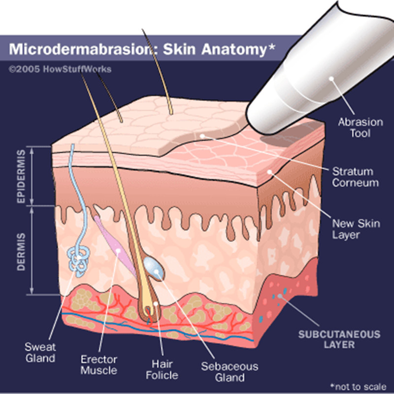 حار بيع Microdermabrasion الماس آلة تقشير الجمال مصنع البيع المباشر