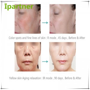 حار بيع الصمام الفوتون العلاج معدات التجميل للعناية بالبشرة