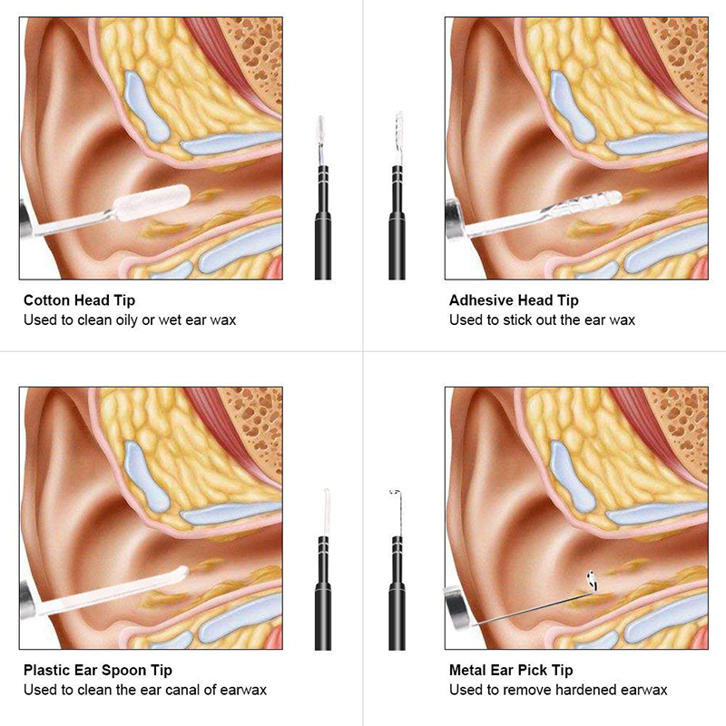 كاميرا لاسلكية WIFI Otoscope 3 في 1 مزيل شمع الأذن 720P مع 6 LED قابلة للتعديل متوافق مع Android و iOS