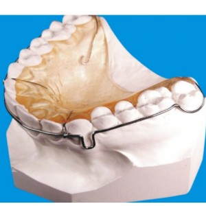 سلسلة تقويم الأسنان